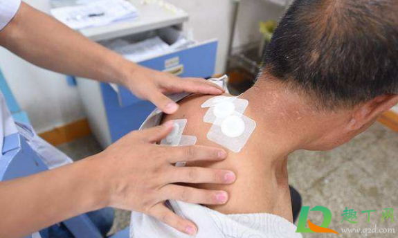 三伏贴一次贴多久 三伏贴每个伏贴几次