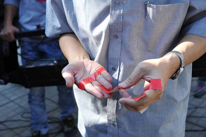 手指上长倒刺很可能是因为（手上为什么会长倒刺）