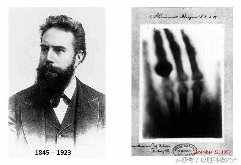 cr是什么意思（X线，CR，DR是一回事吗？）